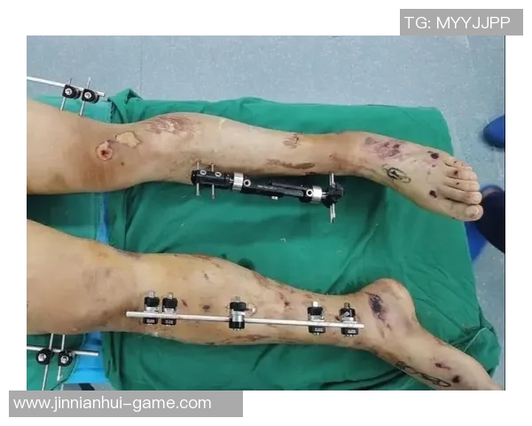 弗拉霍维奇伦敦手术后缺席三个月肌腱重伤情况堪比骨折